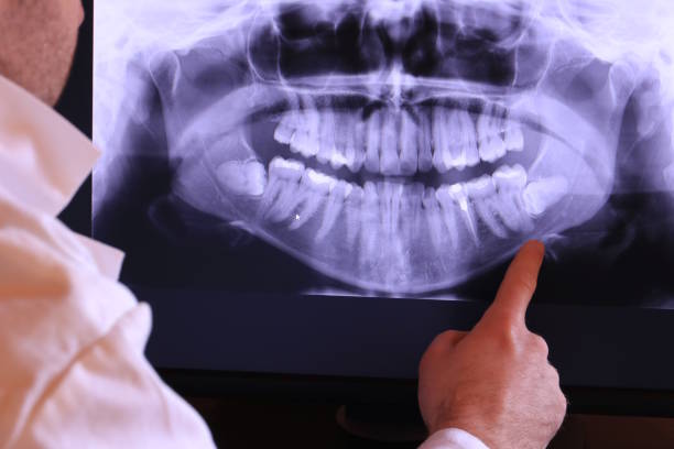 Best Broken or Chipped Tooth Repair in Pleasantdale, NJ